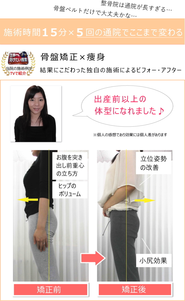 産後の骨盤矯正の効果