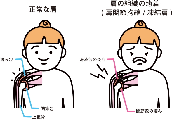 四十肩・五十肩 四十肩・五十肩