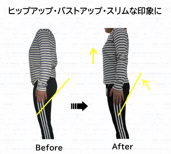 骨盤矯正ビフォーアフター 骨盤矯正ビフォーアフター